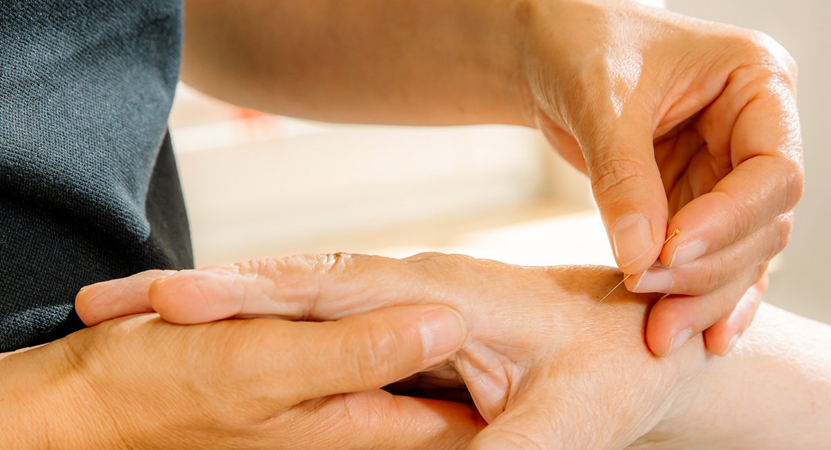 Personal führt Akupunktur an der Hand eines Patienten durch